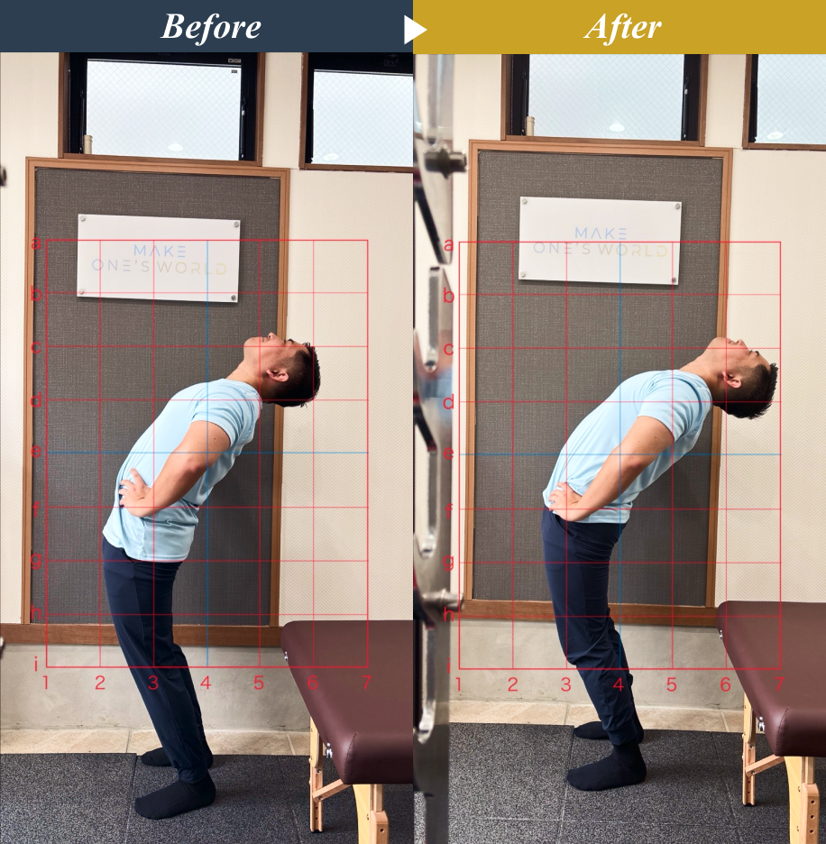 Make One’s World整体院 矢川店のストレッチ整体とエクササイズによる姿勢改善のビフォーアフター事例1