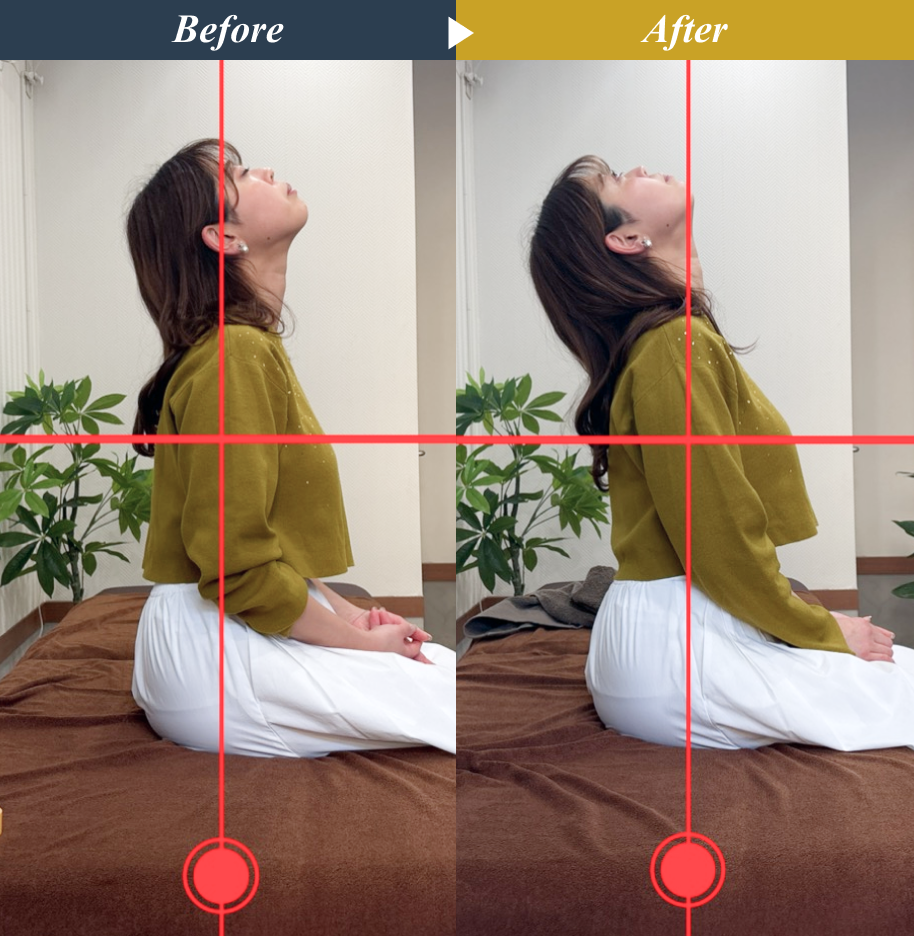 Make One’s World整体院 矢川店のストレッチ整体とエクササイズによる姿勢改善のビフォーアフター事例2