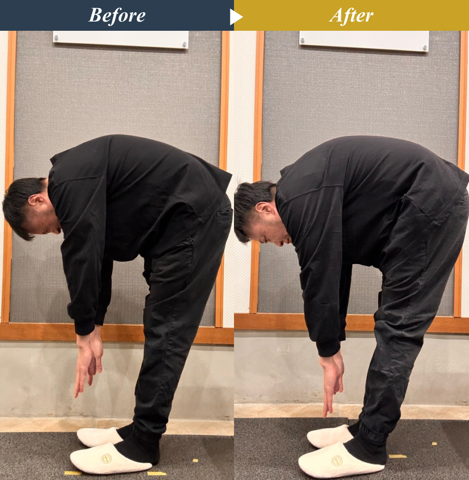 Make One’s World整体院 矢川店のストレッチ整体とエクササイズによる姿勢改善のビフォーアフター事例4